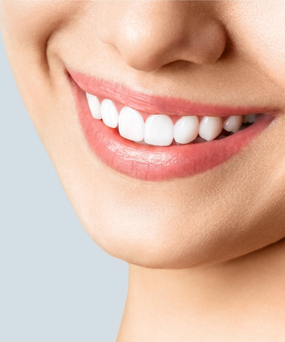 Faccette Dentali Faccette Dentali